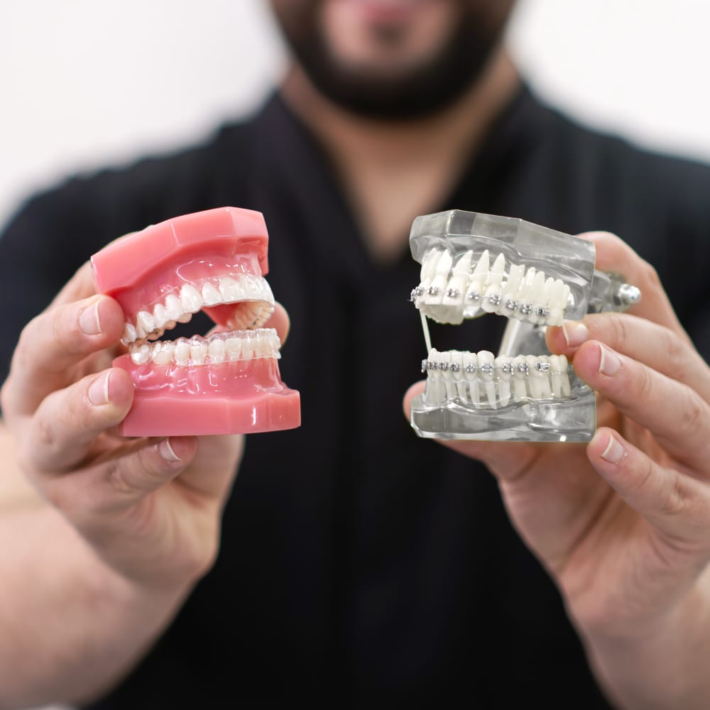 Clear Aligners or Braces at Westview Orthodontics