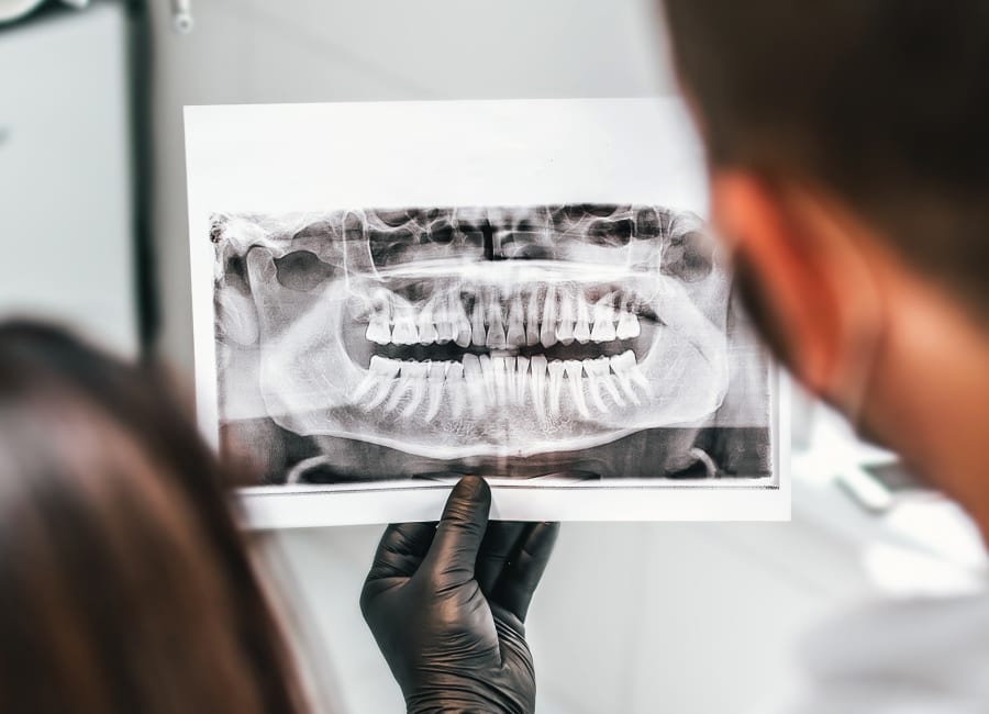 Panoramic X-rays, North Vancouver Orthodontist